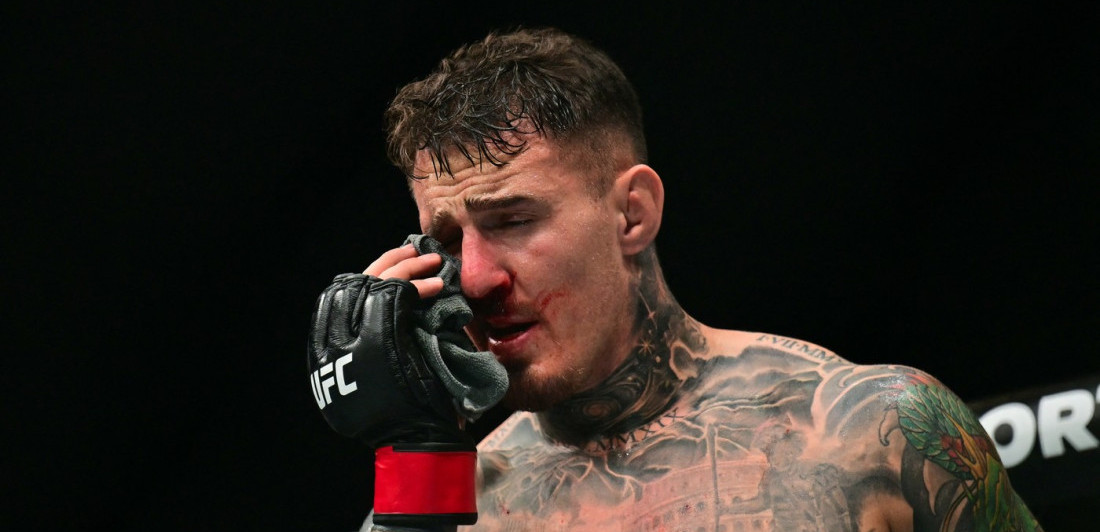 Uopšte nije dobro! Aspinal u izuzetno lošem stanju - ne vidi ništa (VIDEO)