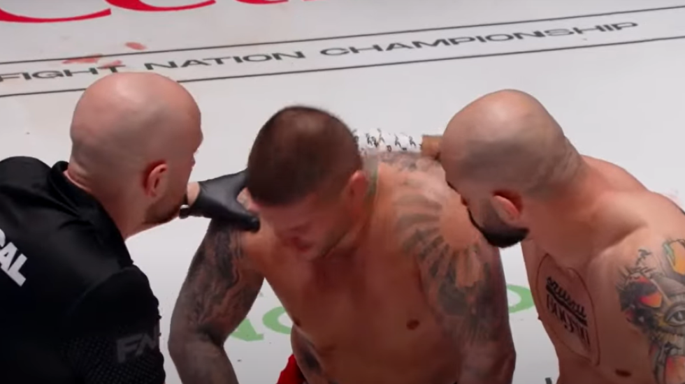 Bakočević doživeo tešku povredu oka? Crnogorac se oglasio usred noći iz bolnice (FOTO)