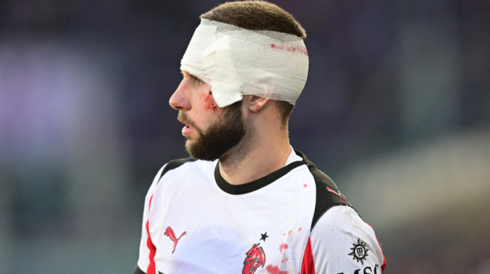 Prva fotografija Strahinje Pavlovića posle povrede glave (FOTO)