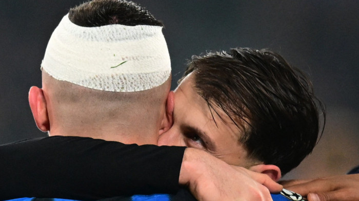 Uznemirujuće: Bivšem igraču Zvezde razbili glavu, pokazao jezive ožiljke (VIDEO/FOTO)