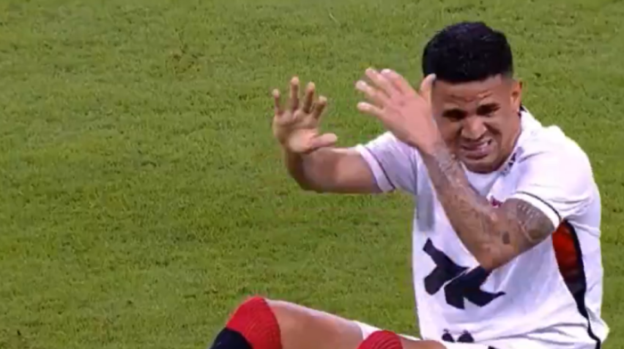 Nije za one sa slabim stomakom: Jeziva povreda u Brazilu (VIDEO)