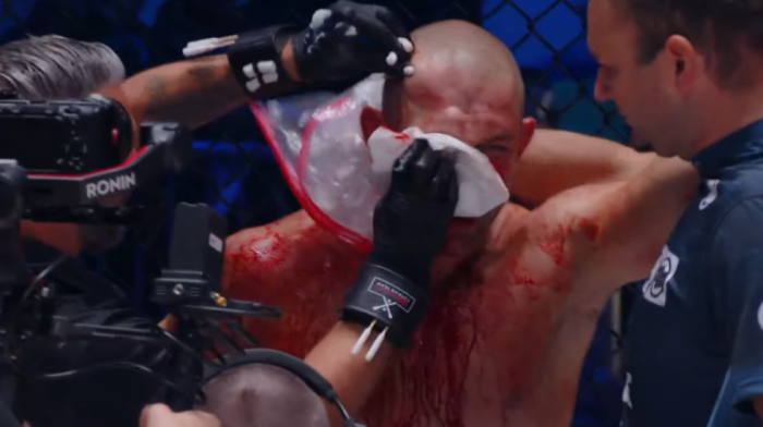 Brutalno! Srbin demolirao Slovenca usred Ljubljane (VIDEO)