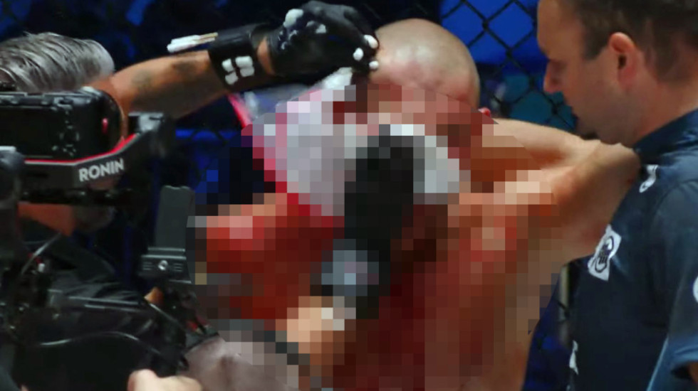 Brutalno! Srbin demolirao Slovenca usred Ljubljane (VIDEO)