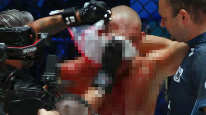 Brutalno! Srbin demolirao Slovenca usred Ljubljane (VIDEO)