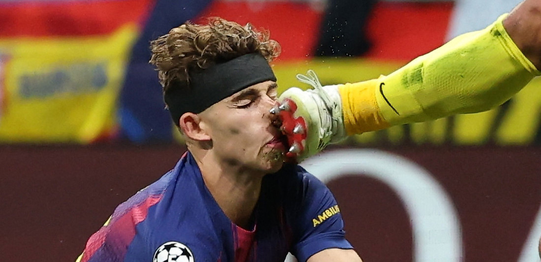 Uznemirujuće: Fermin dobio kopačku u glavu, udarac koji je zaprepastio Evropu (FOTO)