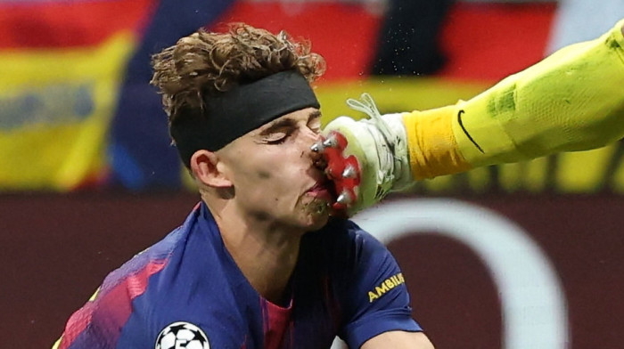 Uznemirujuće: Fermin dobio kopačku u glavu, udarac koji je zaprepastio Evropu (FOTO)