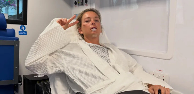 Poznatoj teniserki unakaženo lice: Krenula na Vimbldon, pa polomila bradu i zube