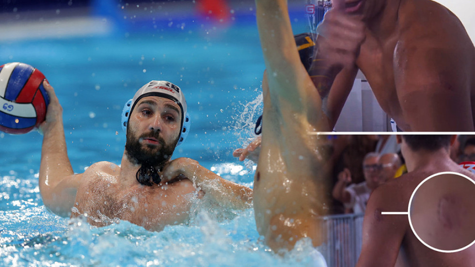 Ozbiljan skandal u finalu vaterpola! Ujeo igrača u sred igre za ruku i leđa
